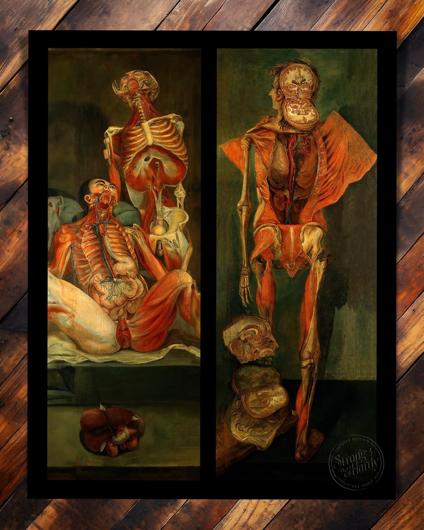 So, we&rsquo;ve had framed restored reproductions of two of Jacques-Fabian Gautier D&rsquo;Agoty&rsquo;s incredible anatomical diptychs hanging in our booth at many of the Oddities and Curiosities Expos this year and have gotten numerous requests for
