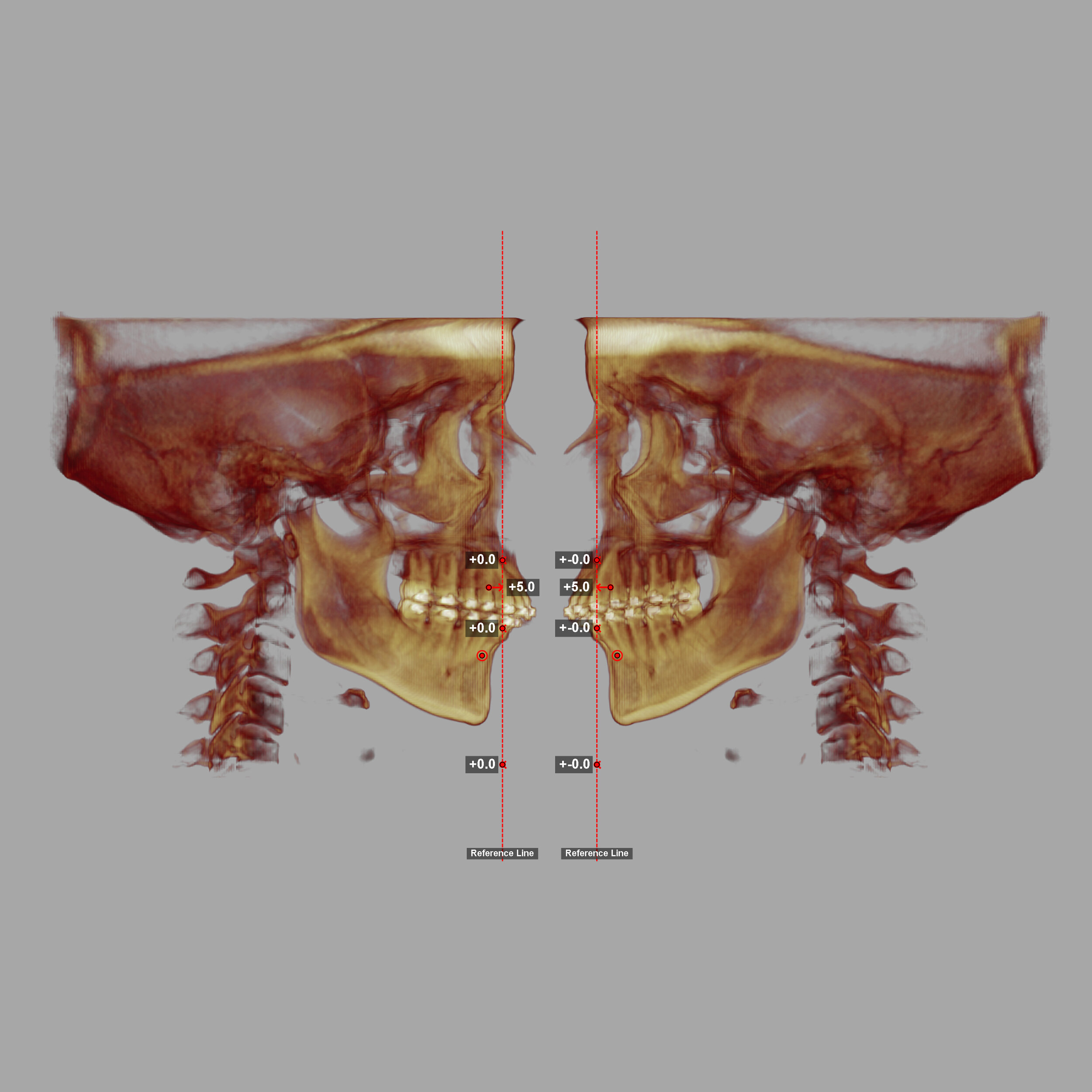 CBCT Surgical Analysis