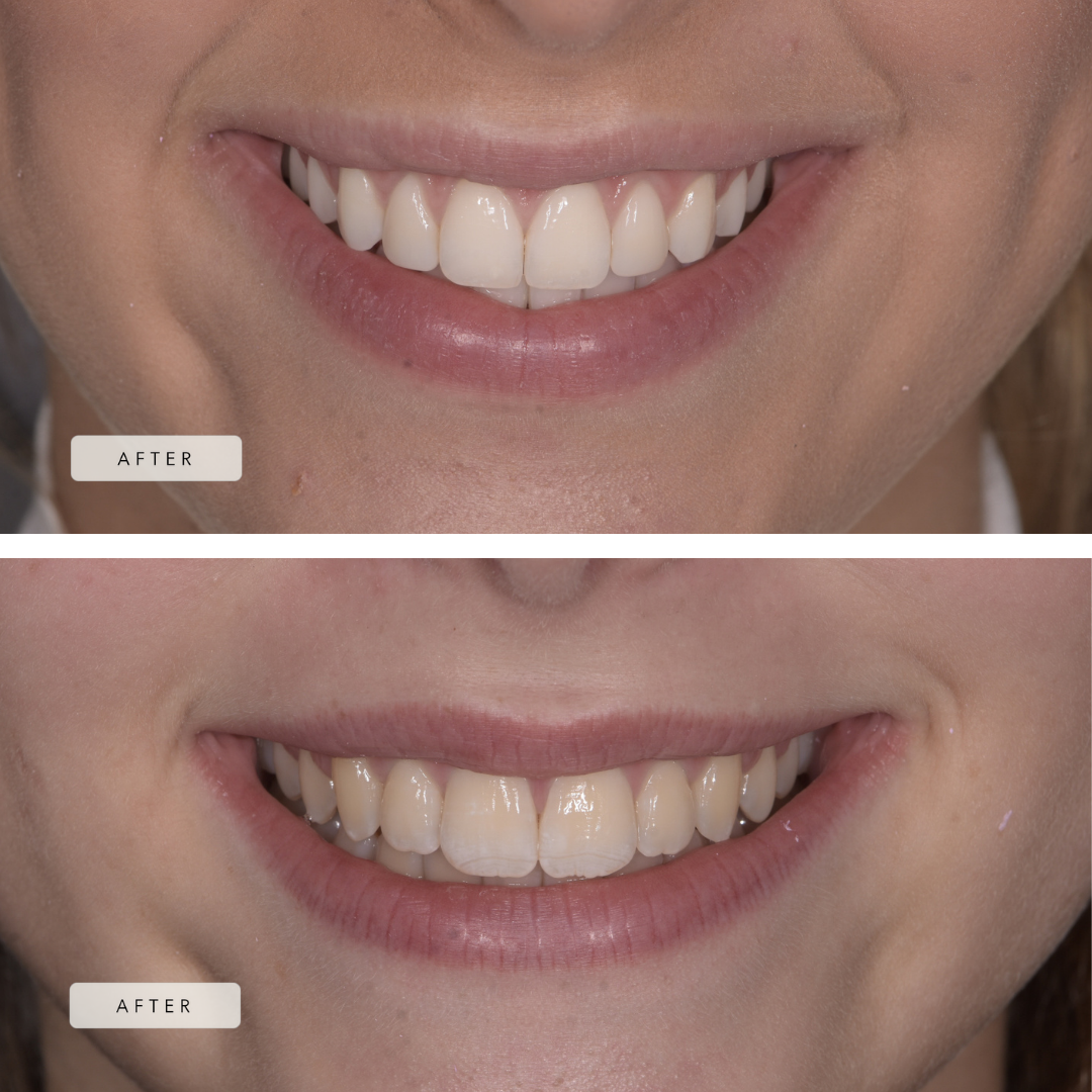 Our patients smiles after treatment