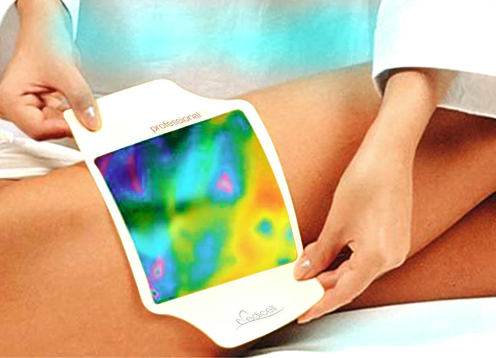 medicell_cellulitis_behandeling_cellmeter_01_rew-Enhanced.jpg