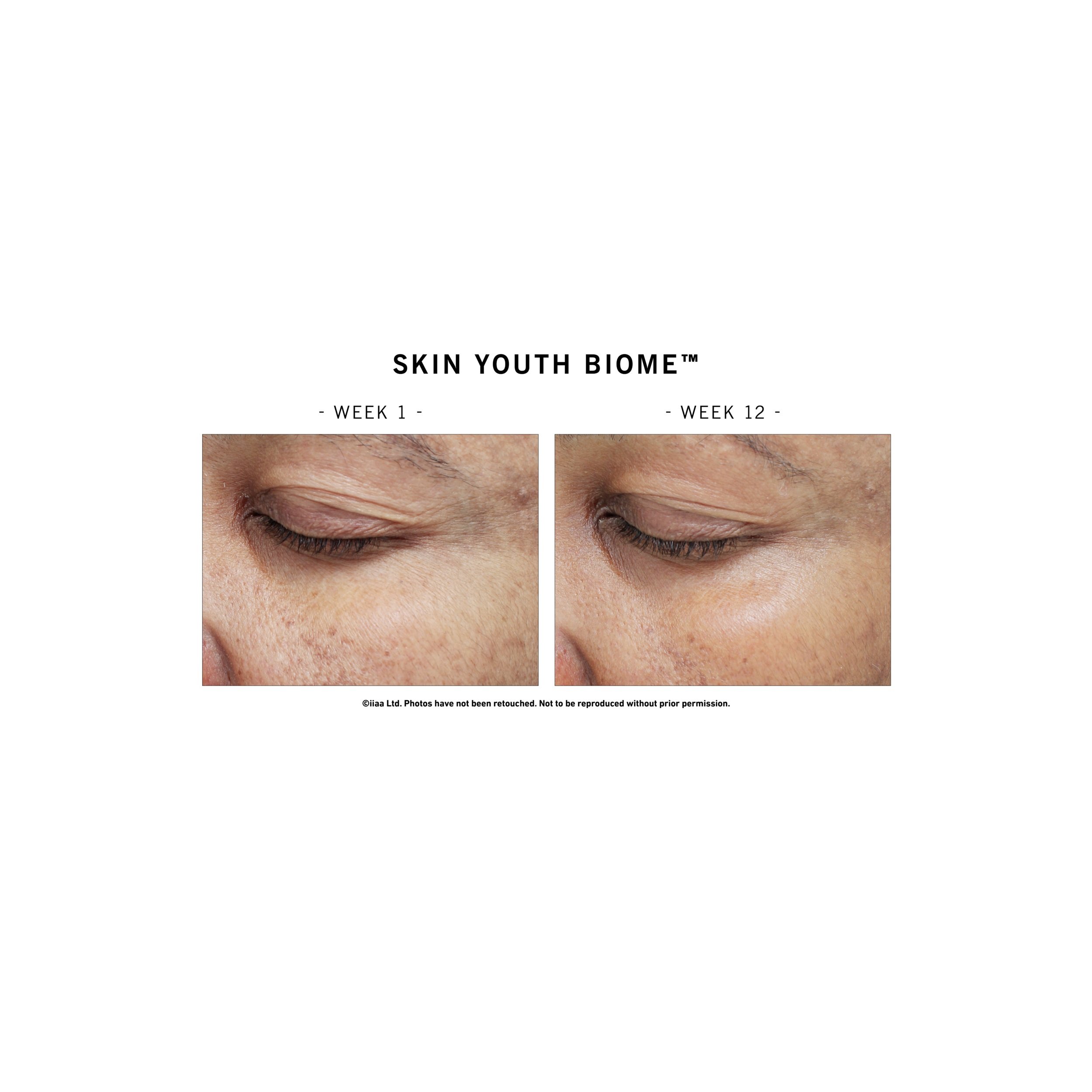 SKIN+YOUTH+BIOME+BEFORE+AFTER.jpg