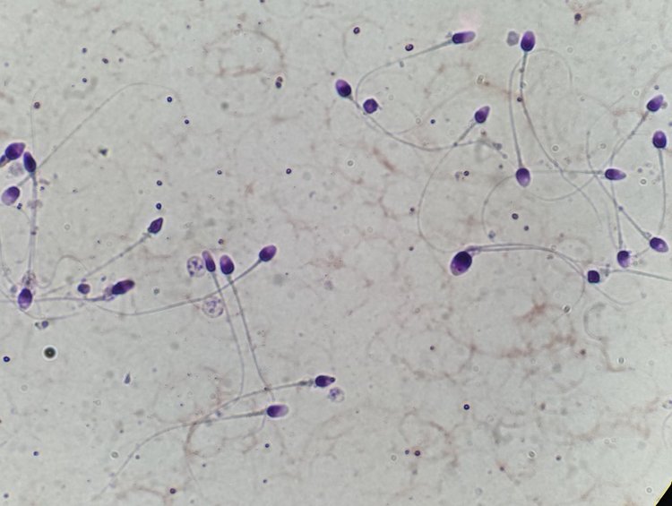 Sperm test