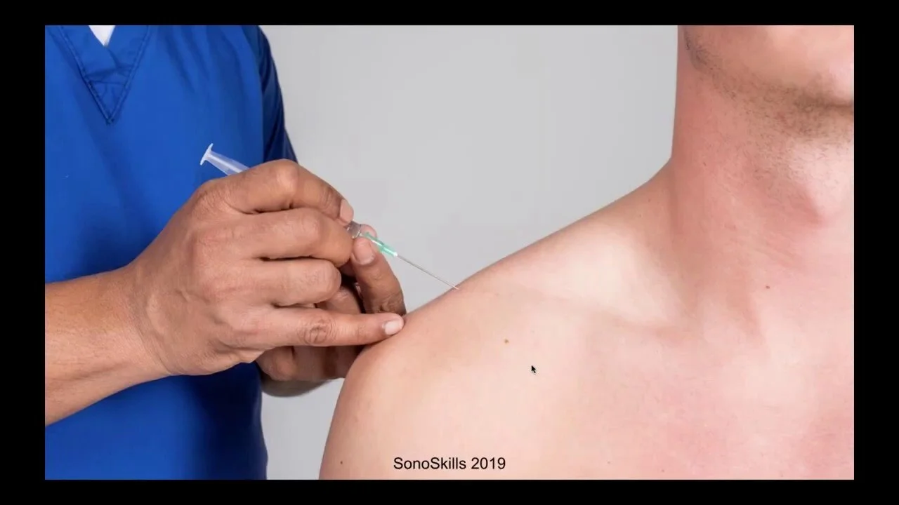 Pacific Radiology: MSK Injections 