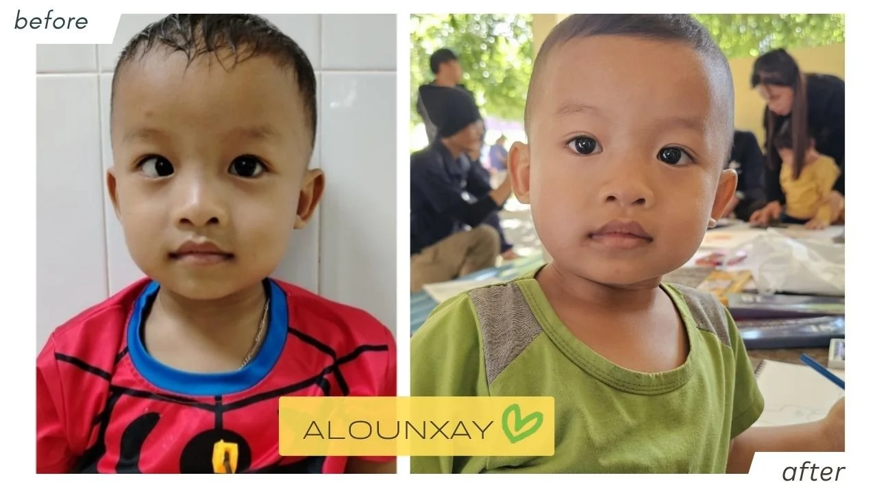alounxay_beforeafter.jpg