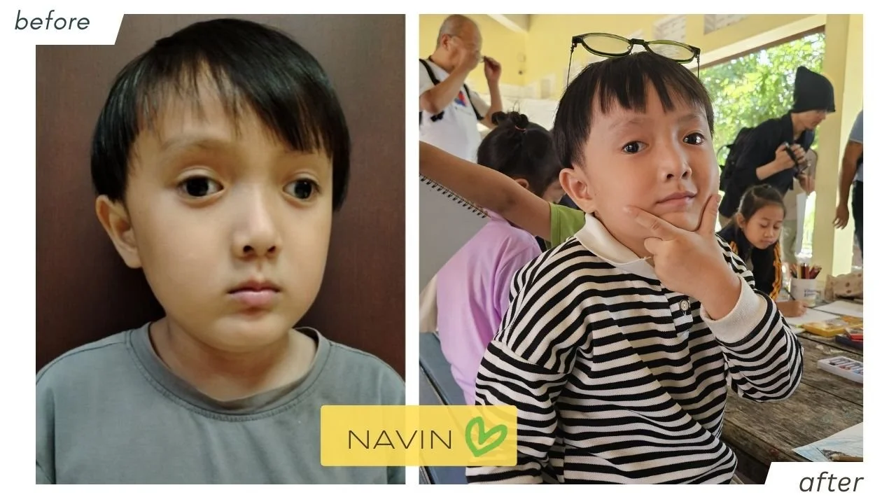 navin_beforeafter.jpg
