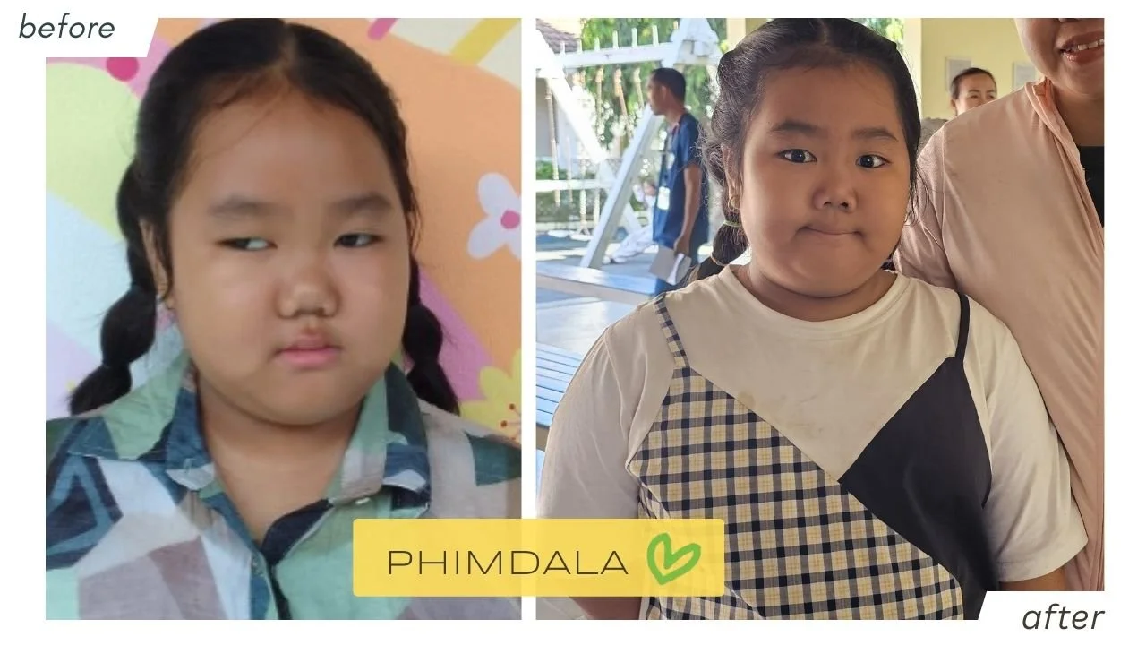 phimdala_beforeafter.jpg