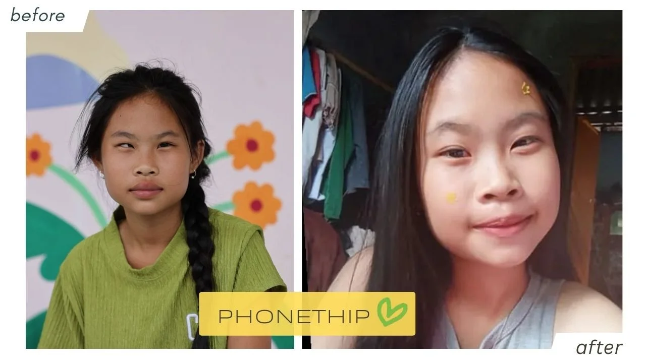 phonethip__beforeafter.jpg