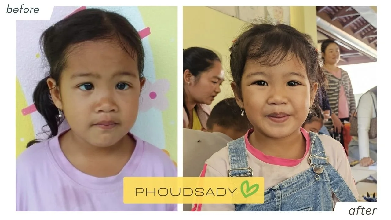 phoudsady_beforeafter.jpg