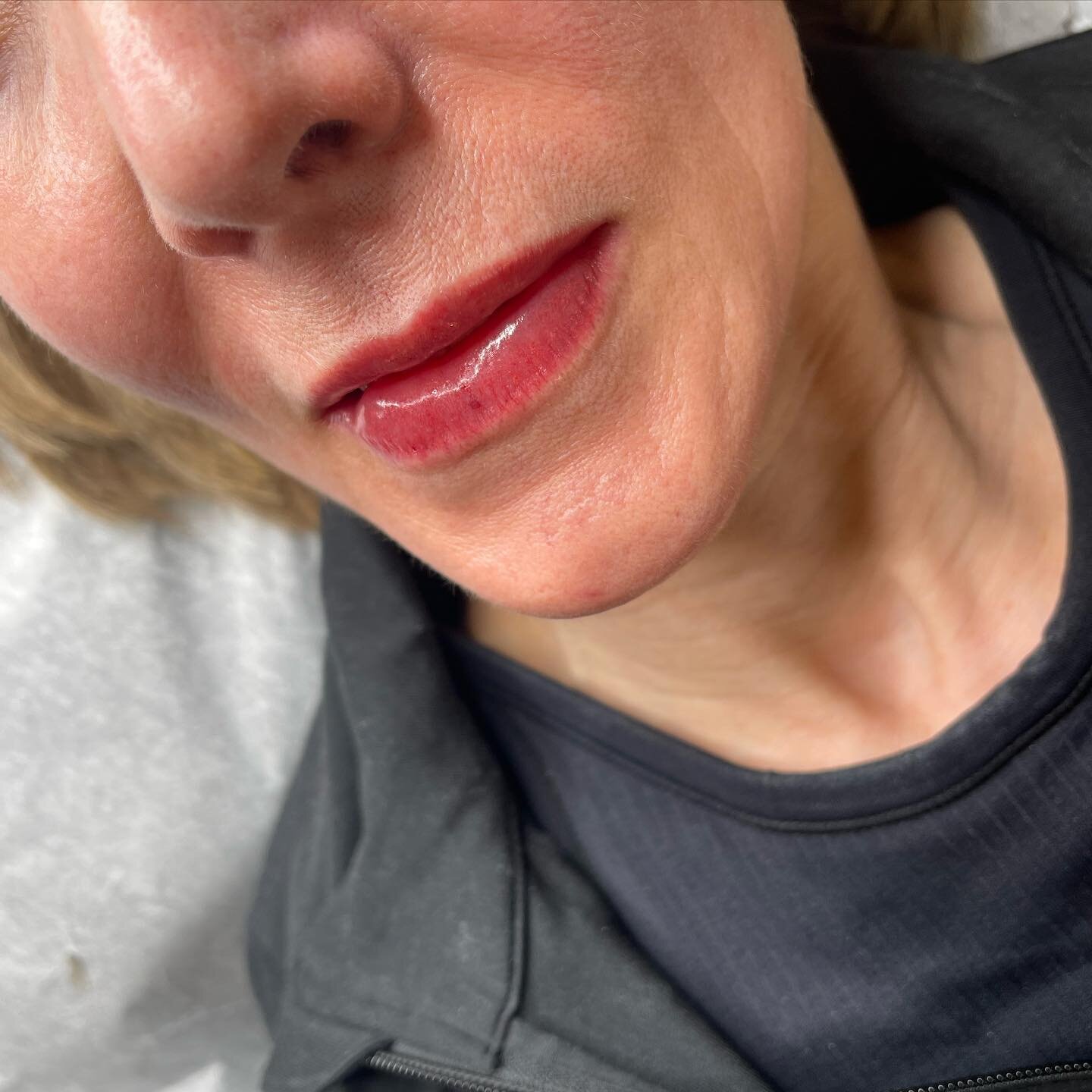 Soft Contour Lip Blush can give the appearance of more voluminous, symmetrical lips. Subtle and natural enhancement to restore and rejuvenate your smile. Scroll to see this transformation! 

💋 Soft Contour Lip Blush by Erin @contour.and.ink | BEVERL