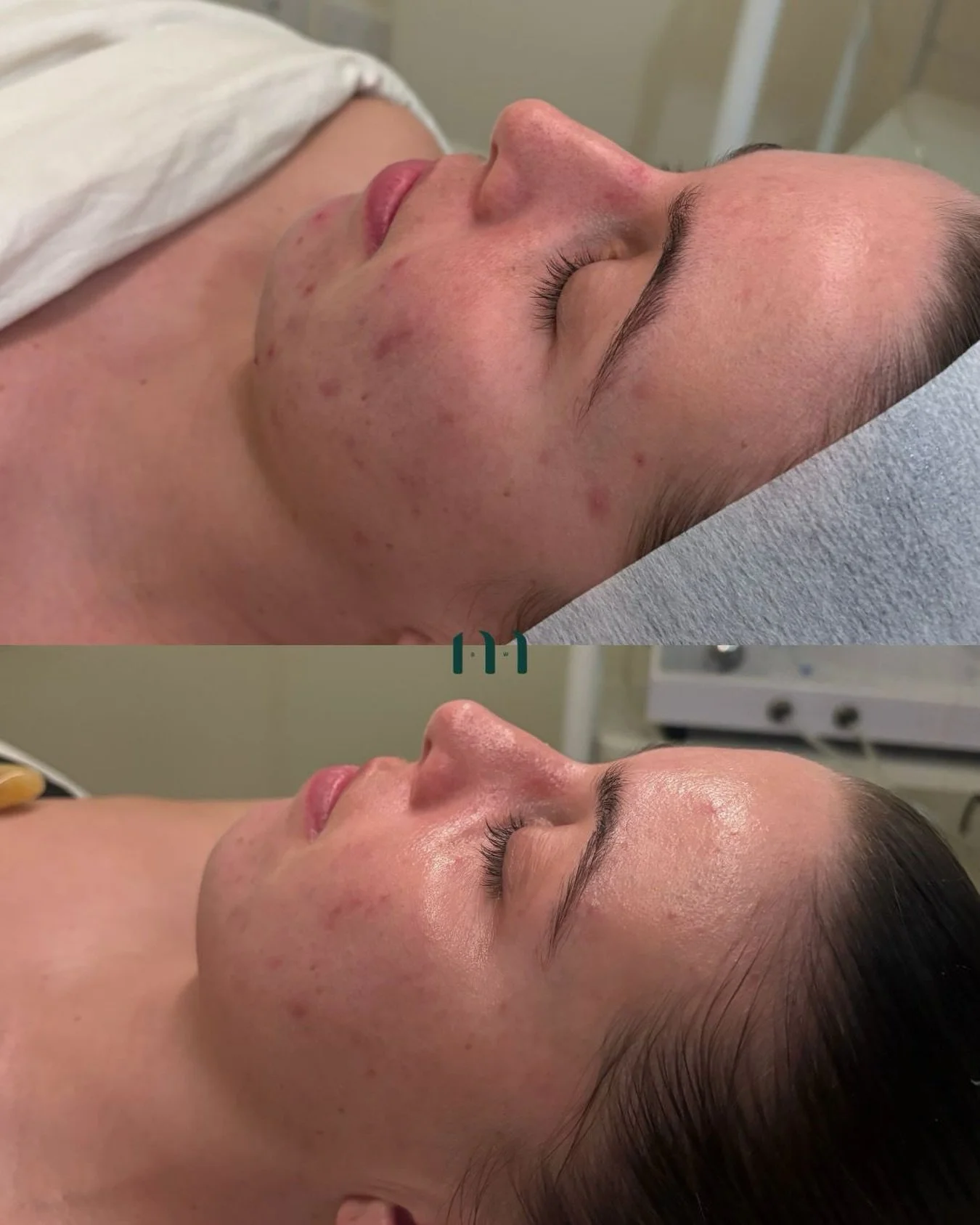Healthy skin starts beneath the surface ~ 

Clearing congestion within the extracellular matrix supports better circulation, fluid movement and a healthier environment for the skin helping to reveal a clearer, healthier-looking glow. 

Our approach o