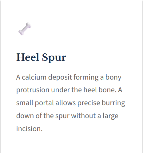 Illustration of a heel spur with descriptive text explaining it as a calcium deposit forming a bony protrusion under the heel bone, including a small portal for precise burr-down of the spur.