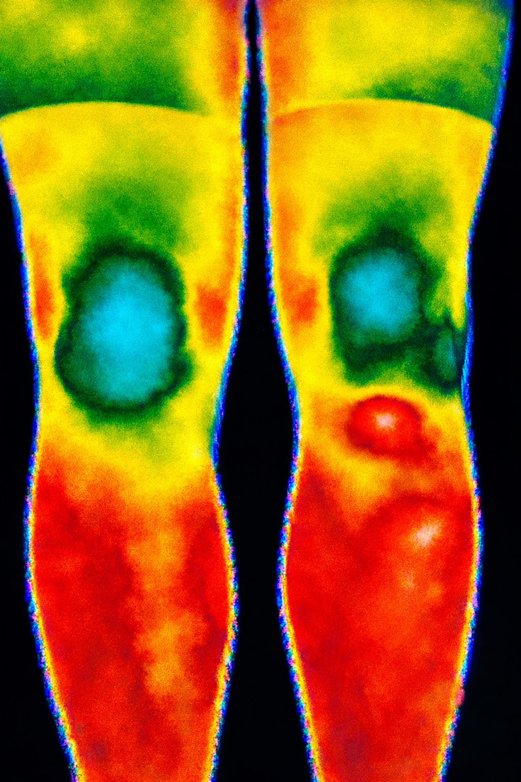 Knee pain on the bike: why the knee is rarely the problem