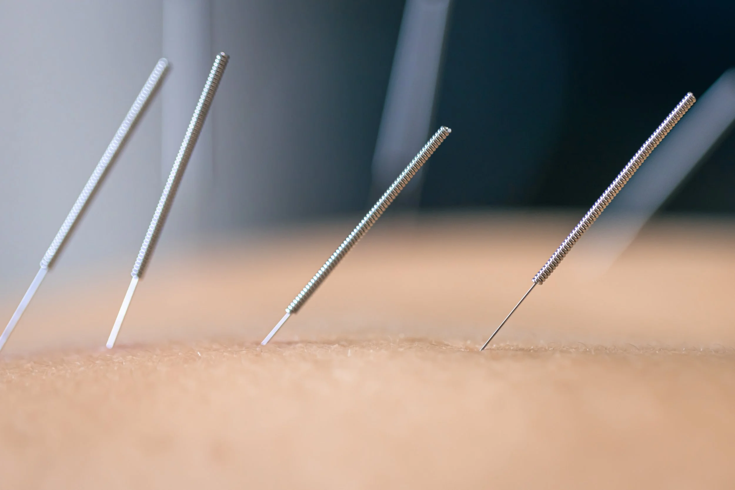 dry-needling-acupuncture-needles-patient-close-up.jpg