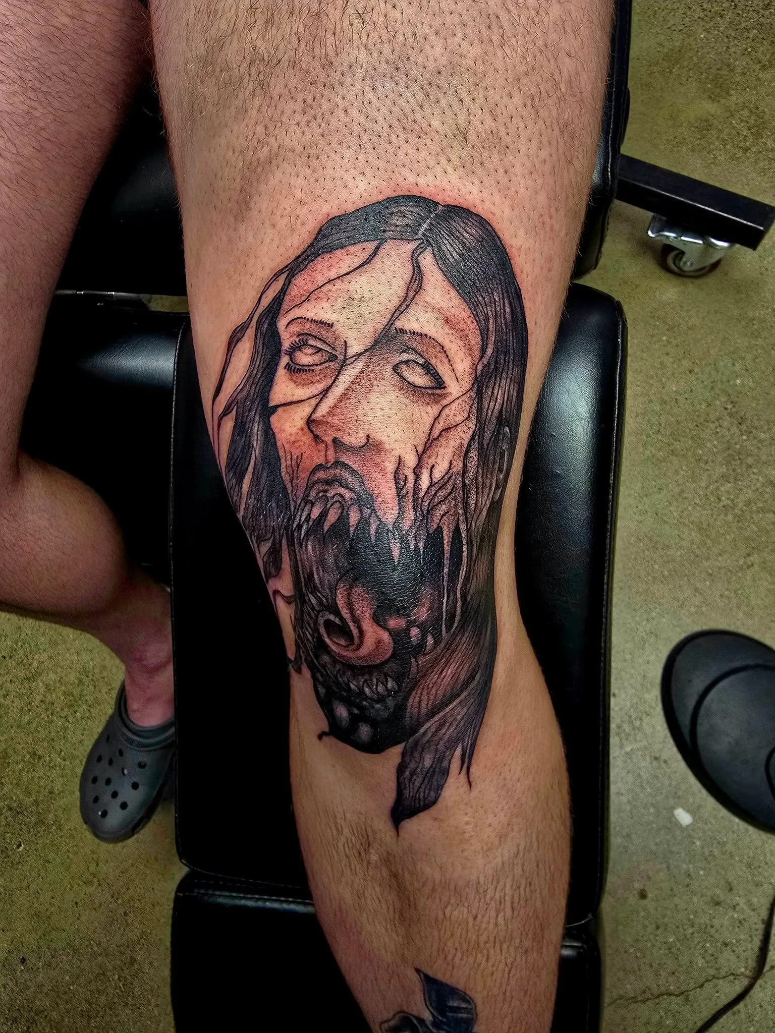 Got to blast this kneecap yesterday.. had alot of fun with this one!!
DM me for an appointment!!