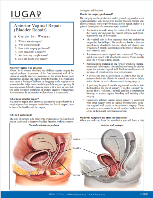 ProVate Gets FDA Approval to Treat Pelvic Organ Prolapse - MPR