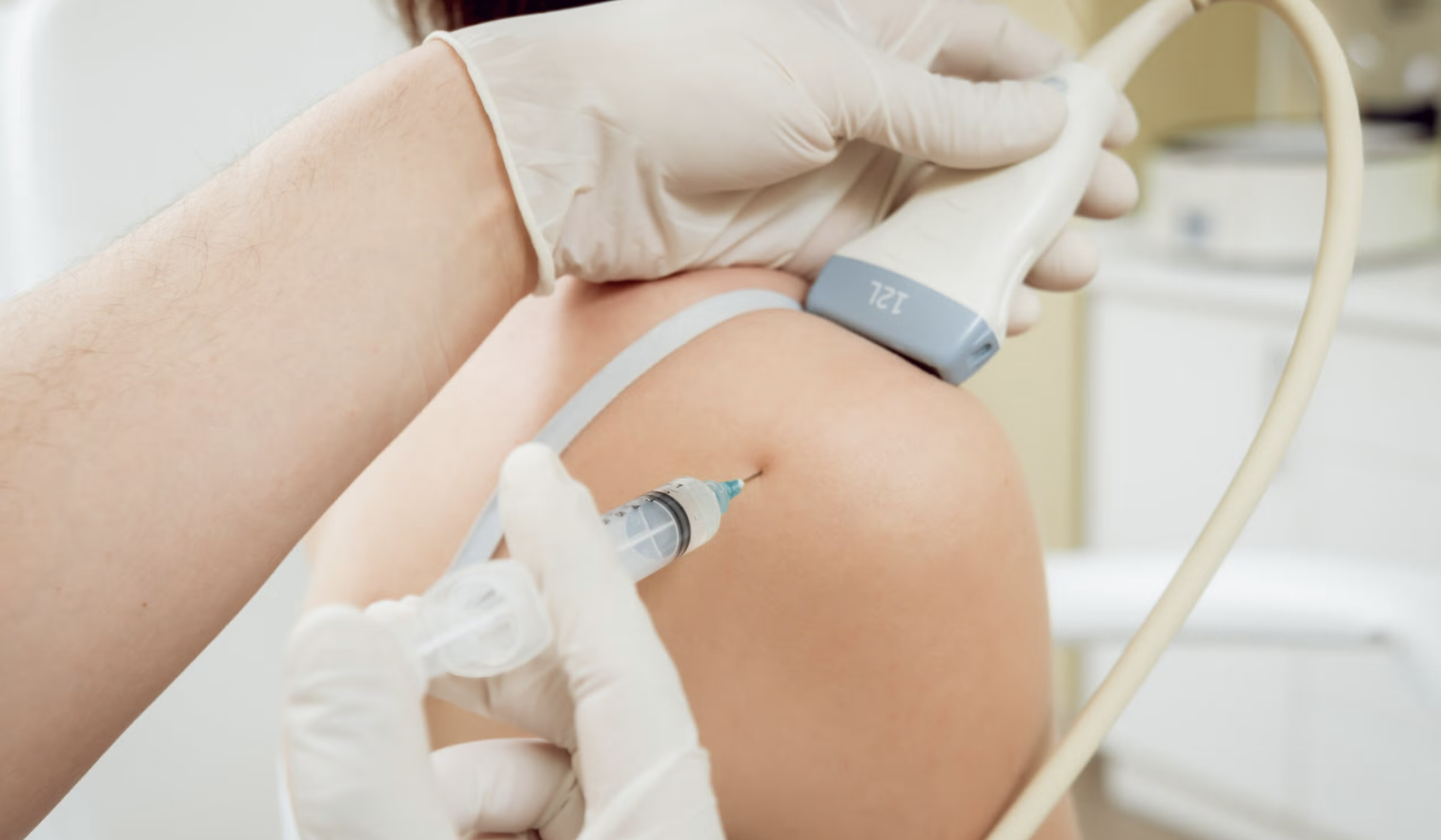 corticoid injections steroids being applied with ultrasound on shoulder.png