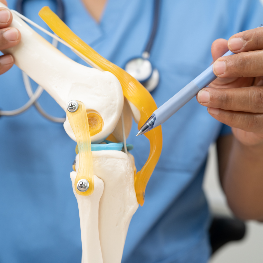 Model depicting the knee in flexion and showing the knee cap which can be a source of pain