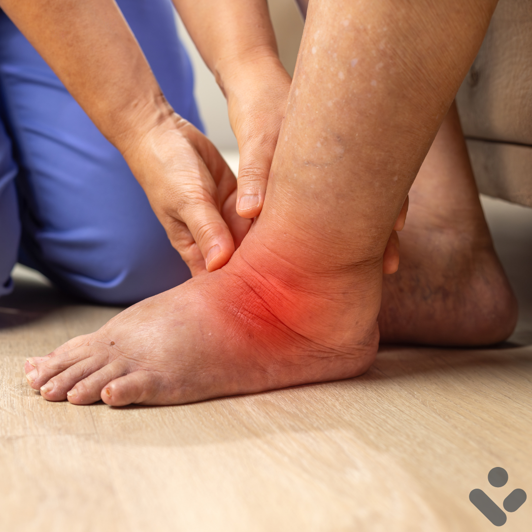 Tissue Healing