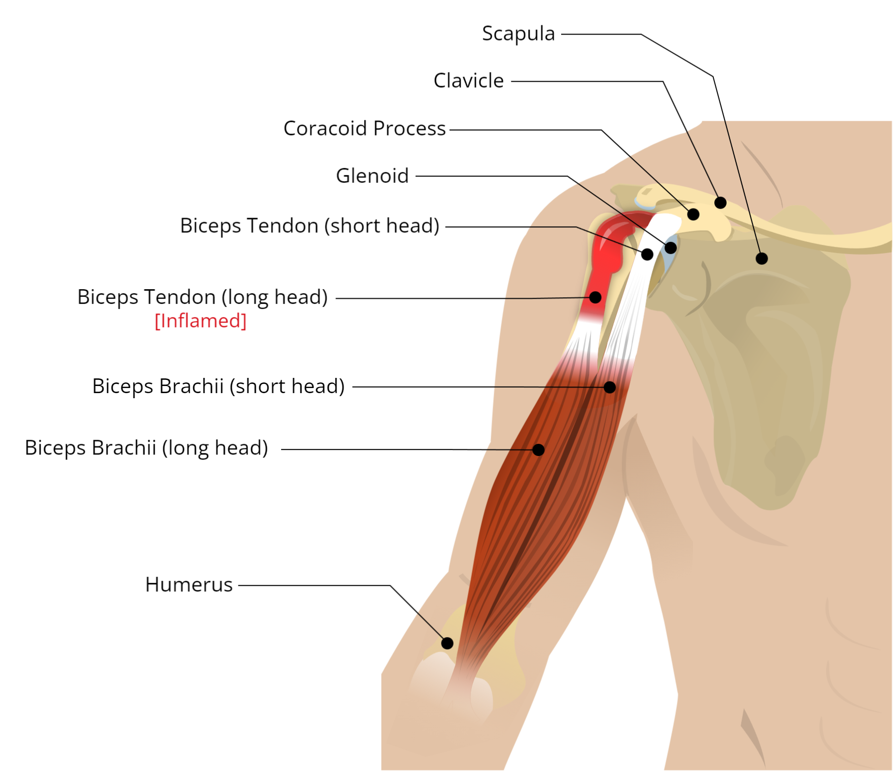 Biceps Brachii Long Head Biceps Brachii Long Head