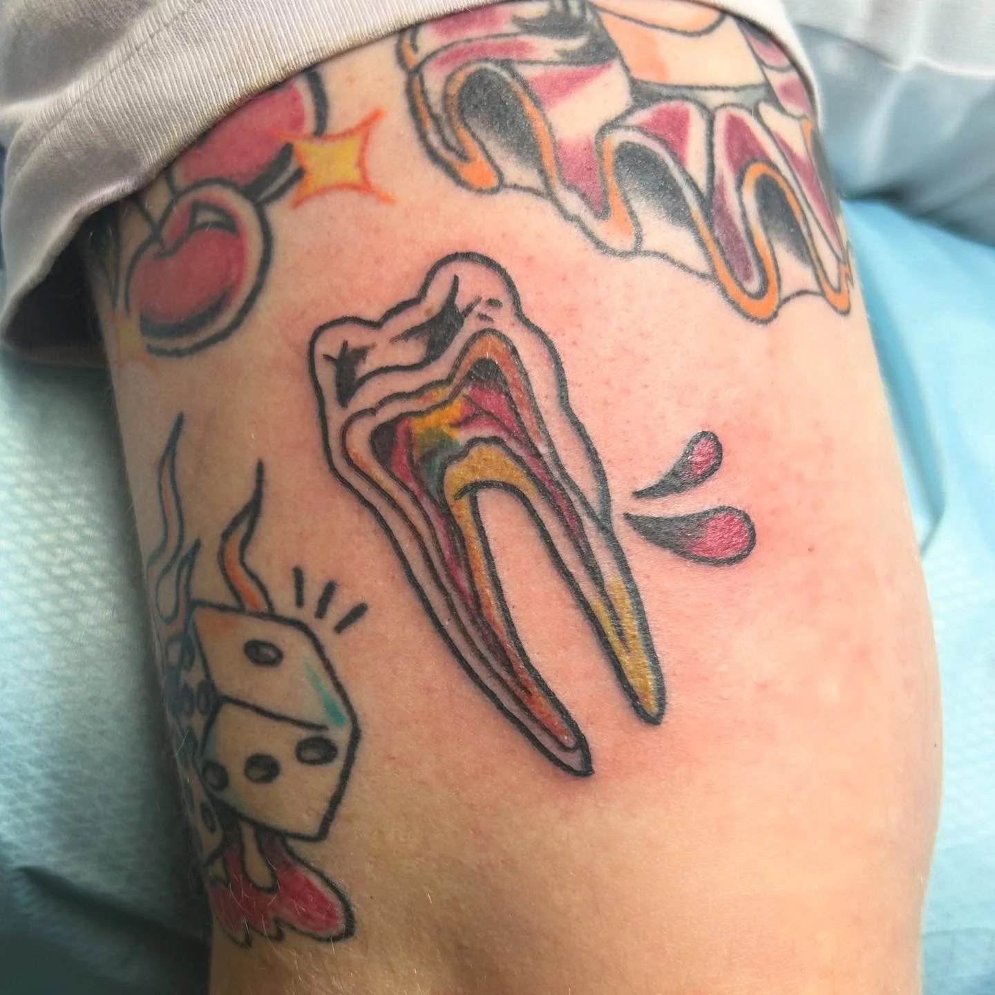 exposed nerves >:&bull;) fun trad stuff for @speakingdiamond