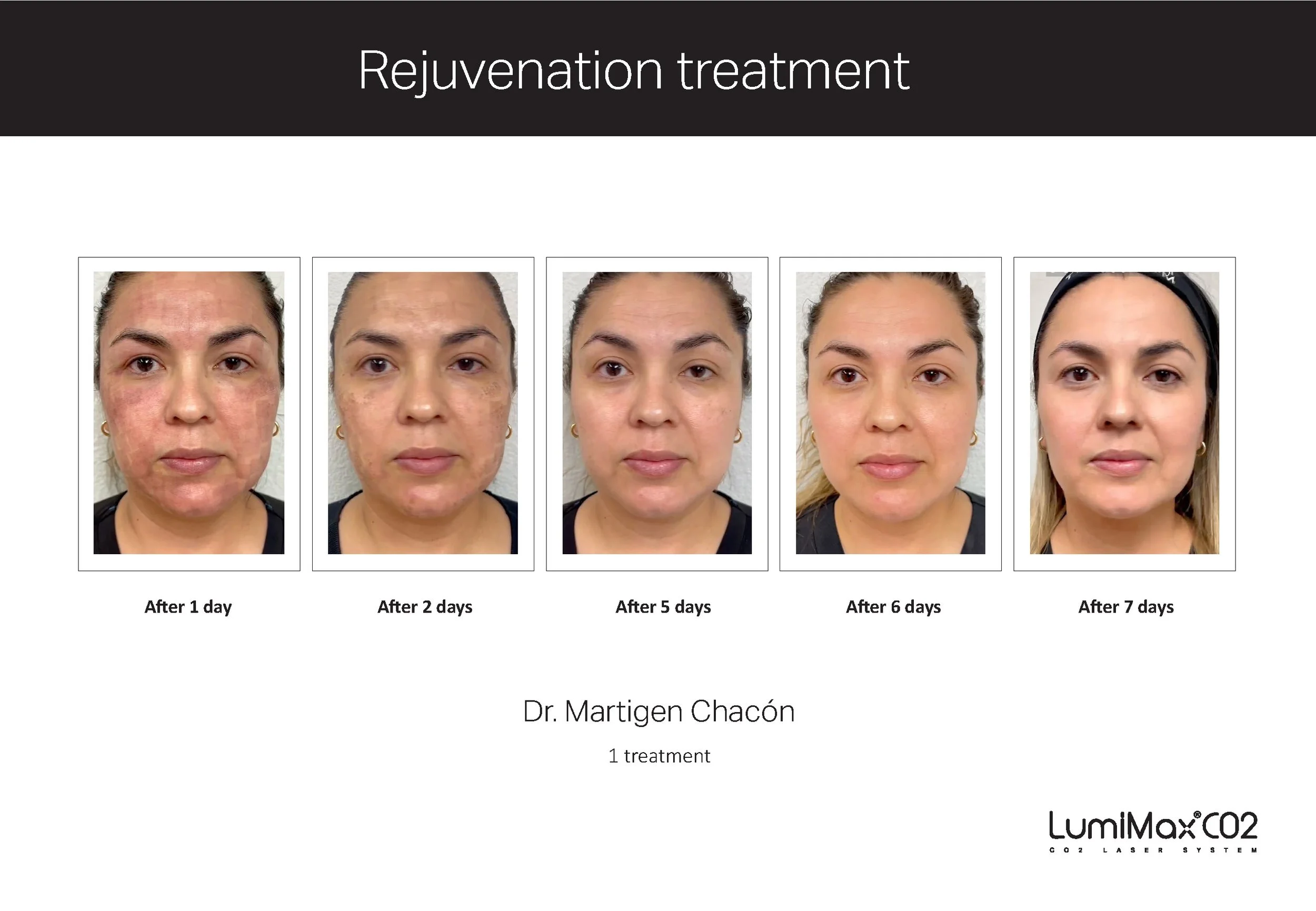 Clinical Studies LMX CO2_ENG_V1.0_Page_03.jpg