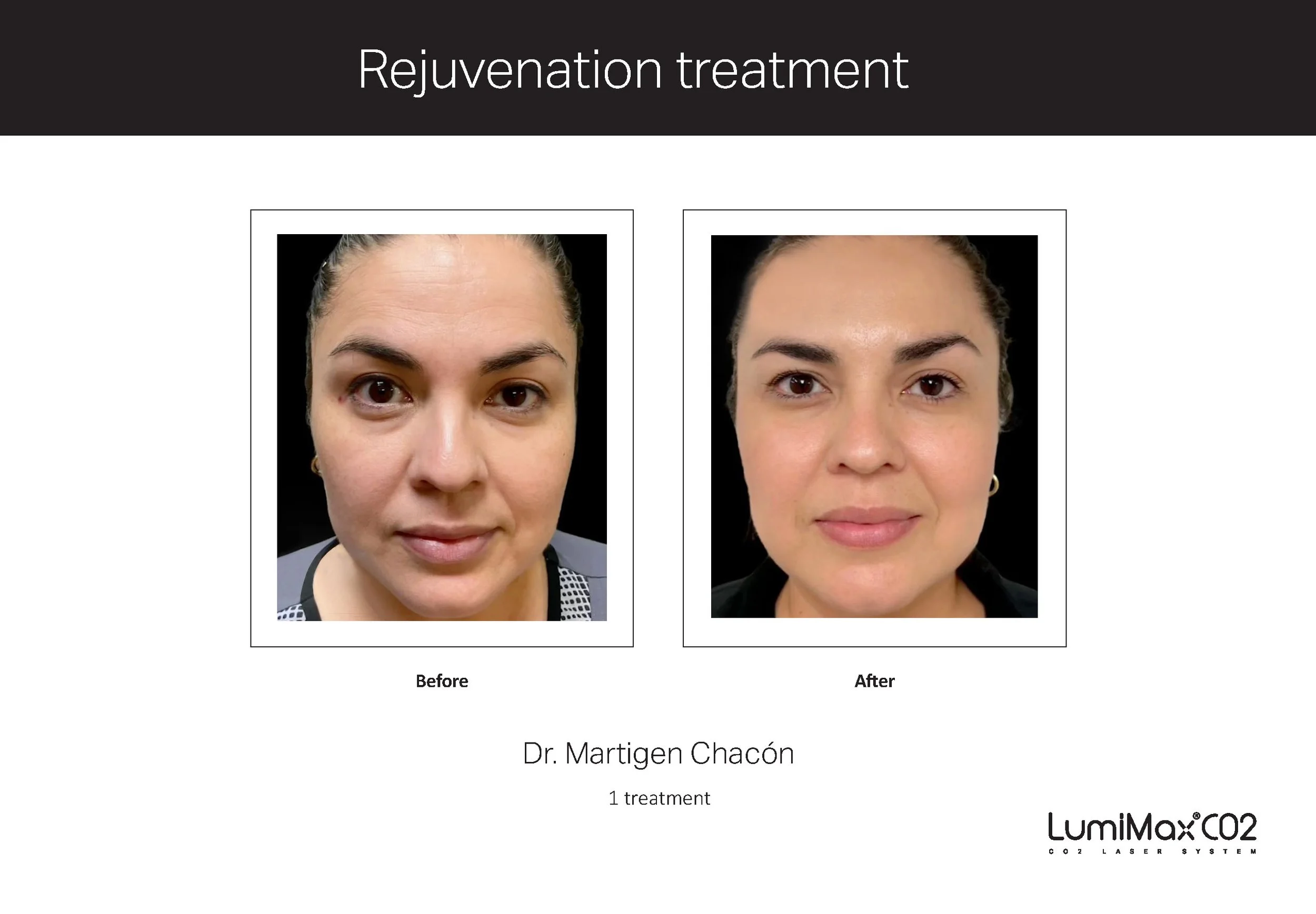 Clinical Studies LMX CO2_ENG_V1.0_Page_02.jpg