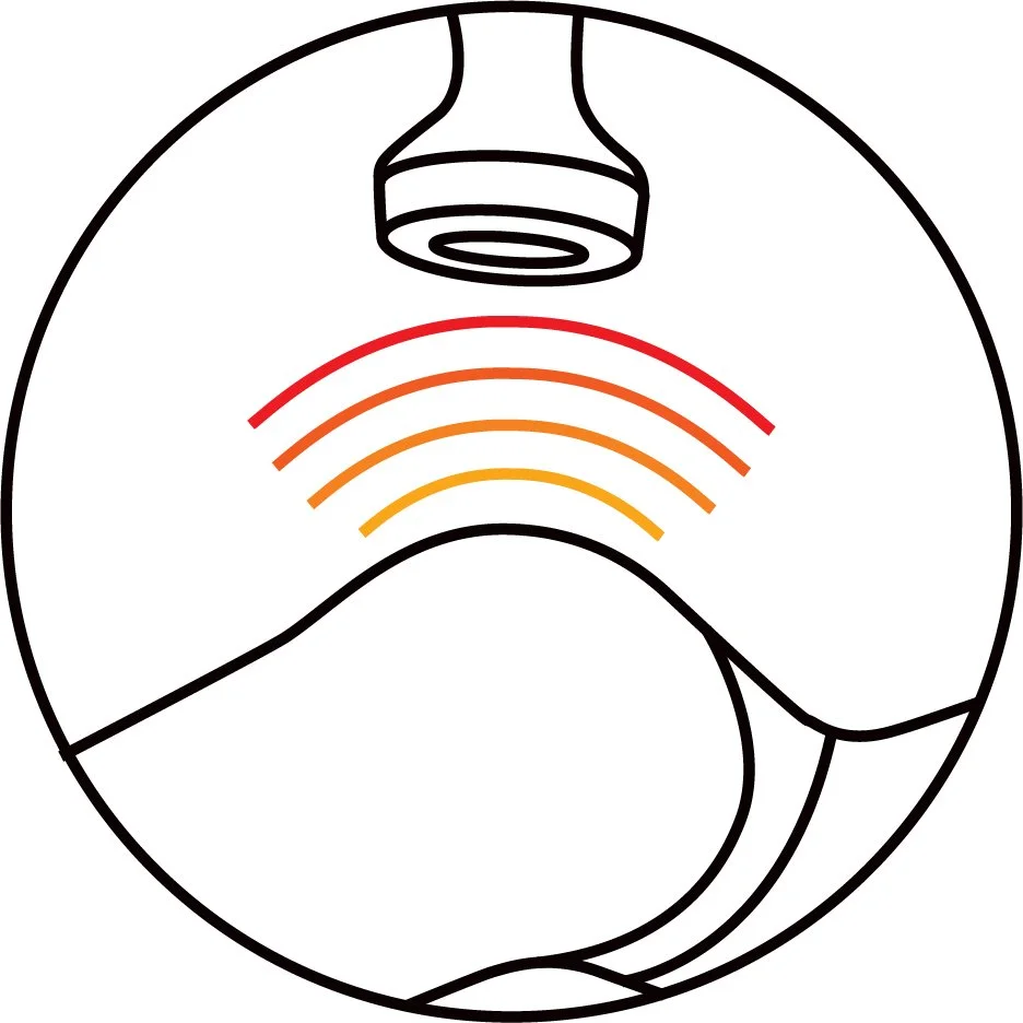 Superpulse technology