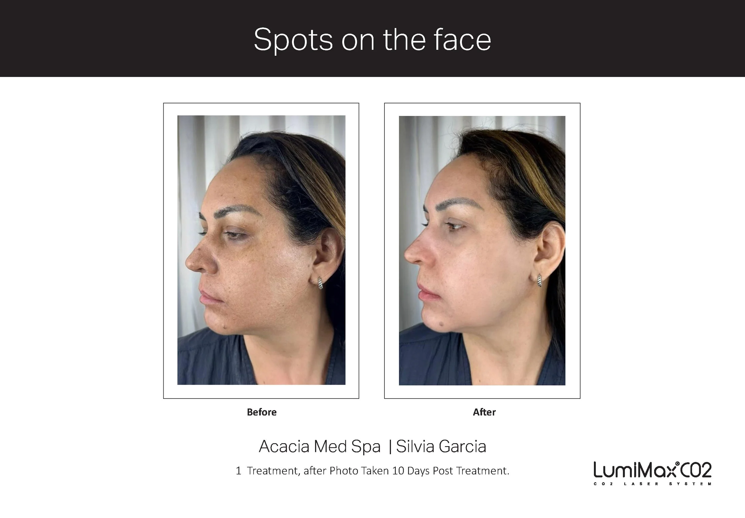 Clinical Studies LMX CO2_ENG_V1.1 (dragged)_Page_1.jpg