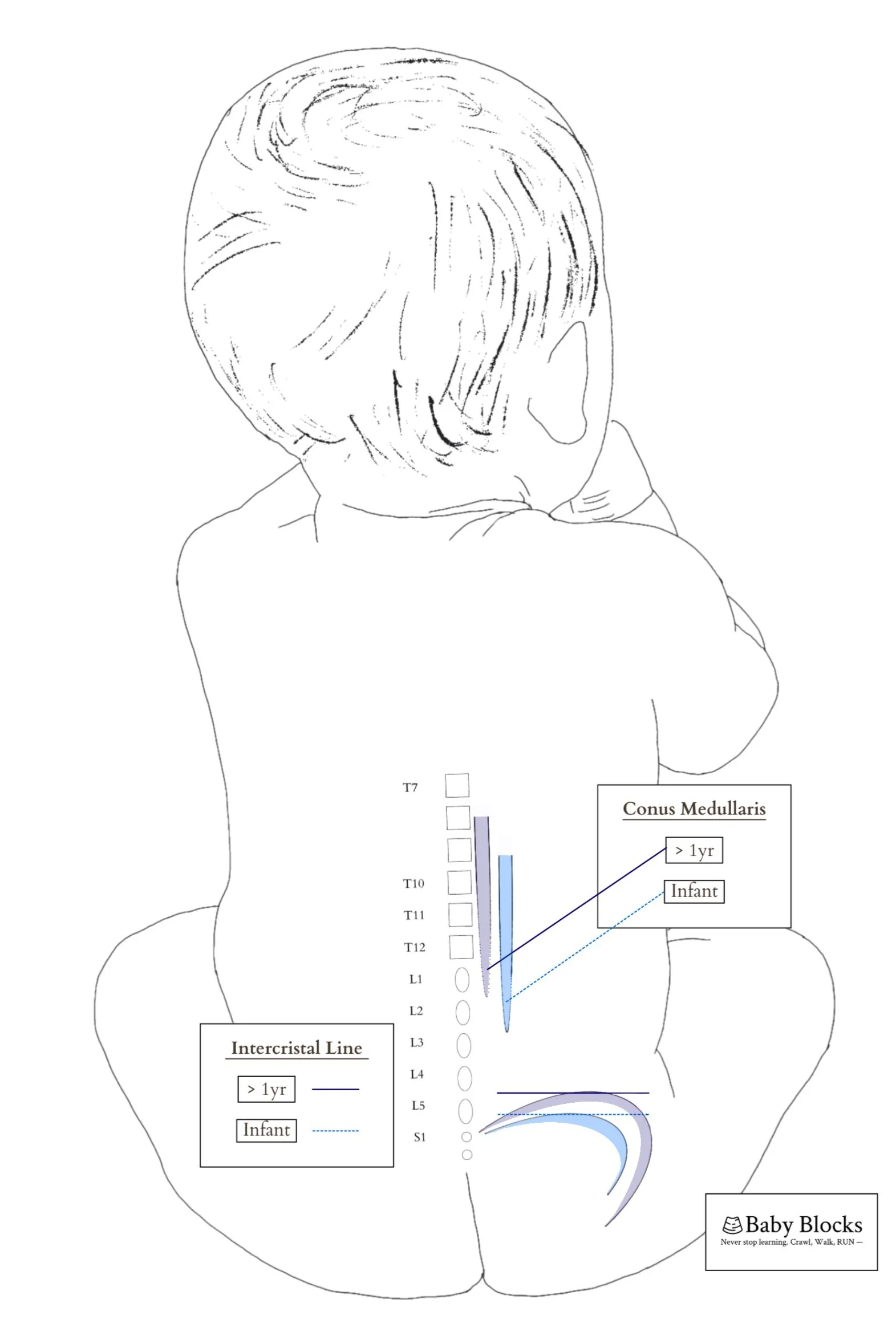 Pediatric Spinal Anesthesia: Technique & Dosing | Baby Blocks — BABY BLOCKS