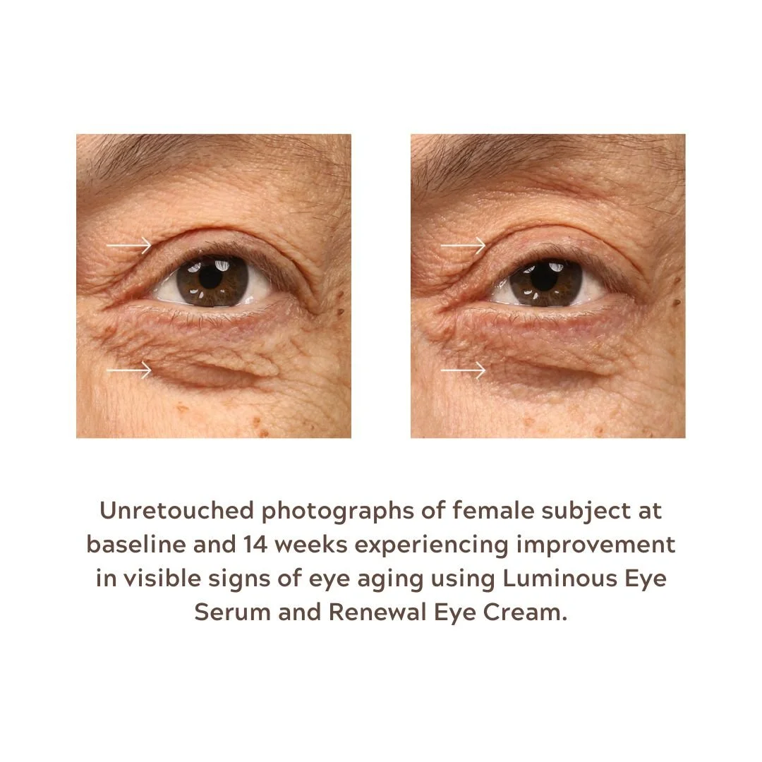 Epionce Eye Duo B&A.jpg