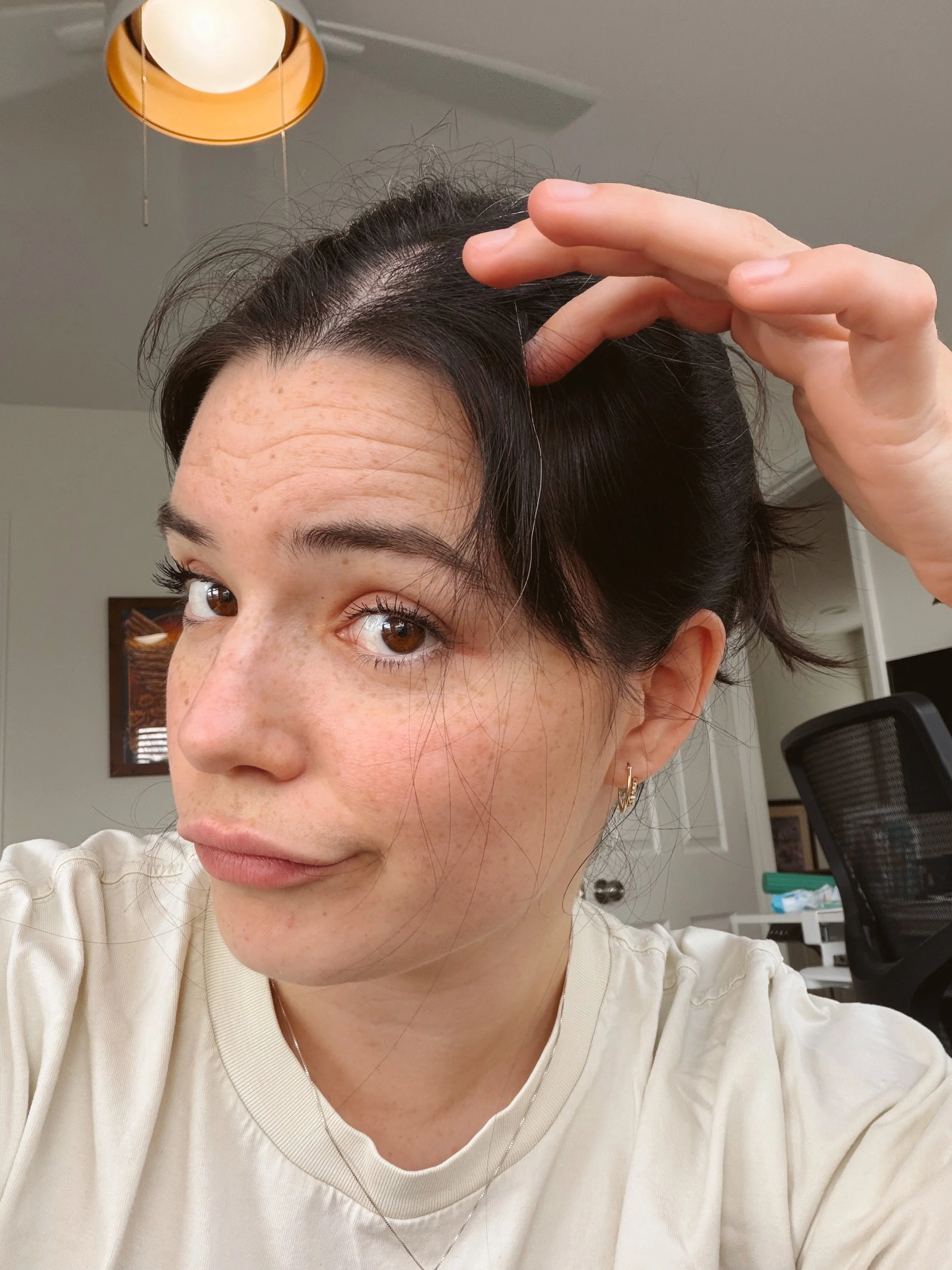 Postpartum hair regrowth is a struggle