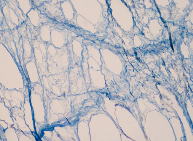 A photo showcasing the connective tissue of fascia