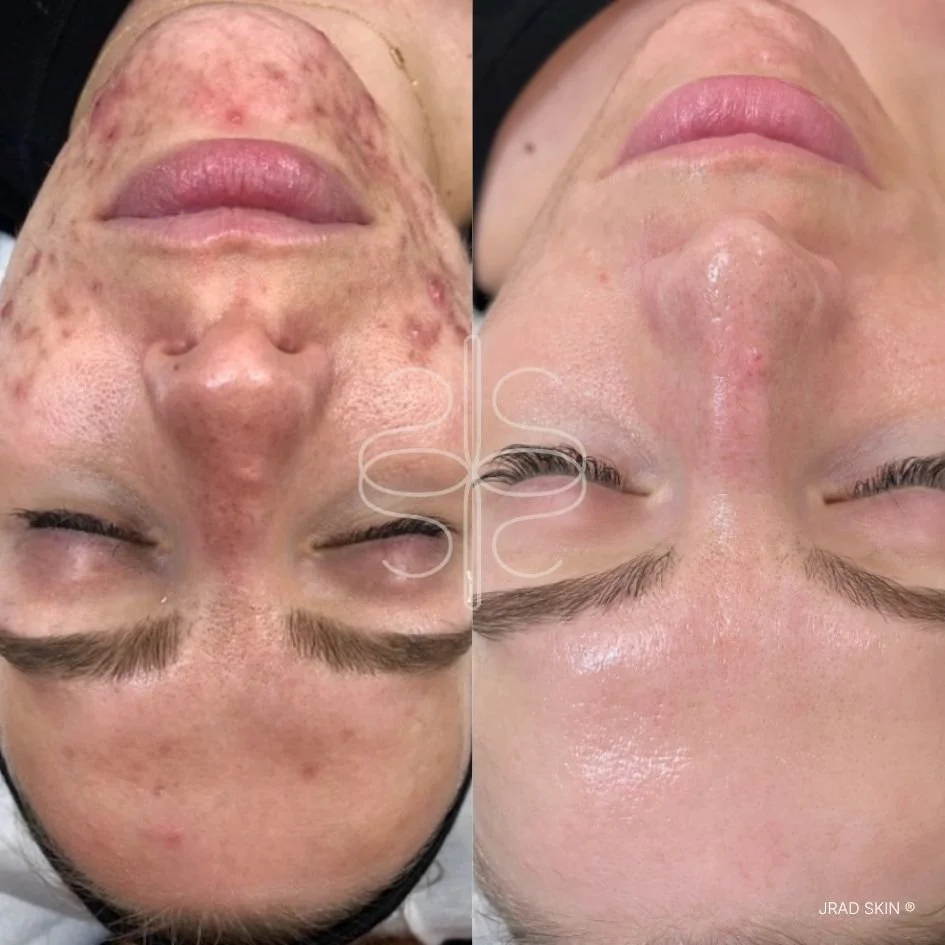 Amanda's Transformation