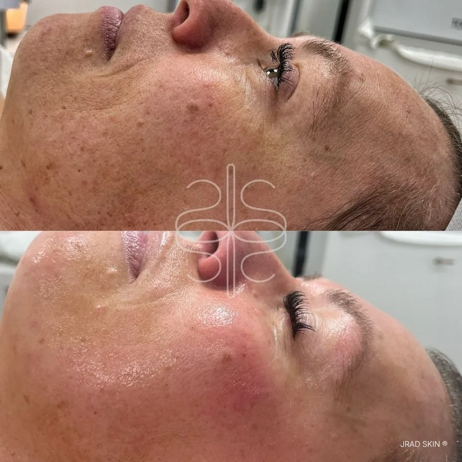 Kaela's Transformation