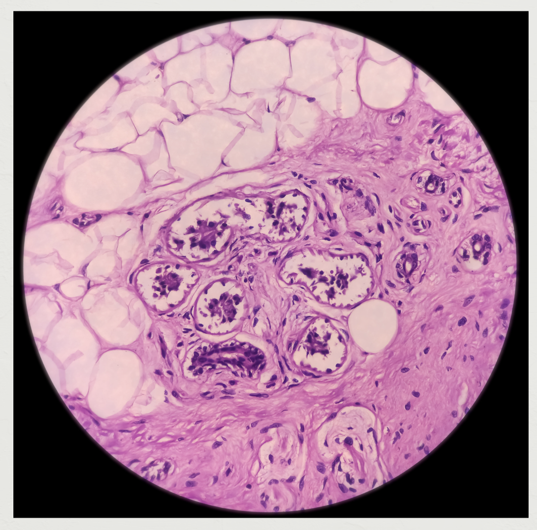 Picture of an image for pigment producing cells
