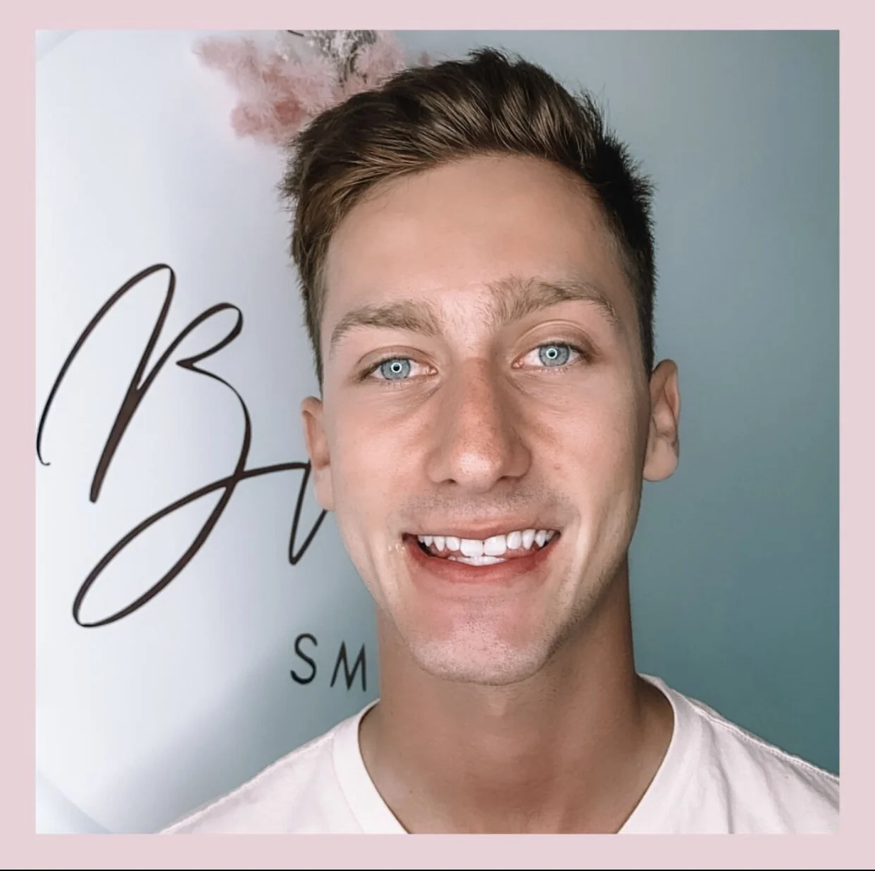 Premium Cosmetic Whitening Treatment