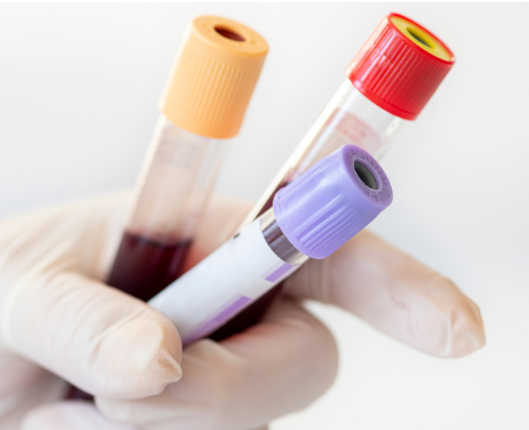 Eine neue klinische Studie startet bald