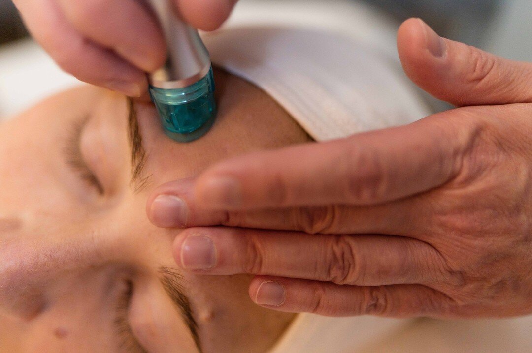 The favorites of favorites during our Hydro Luxx facial are... 

Hydro extractions! The results of this facial are AMAZING and can be seen immediately! 💨

Pamper you and your skin by booking your facial ➡️ Link in Bio! 

#facials #skincare #beauty #