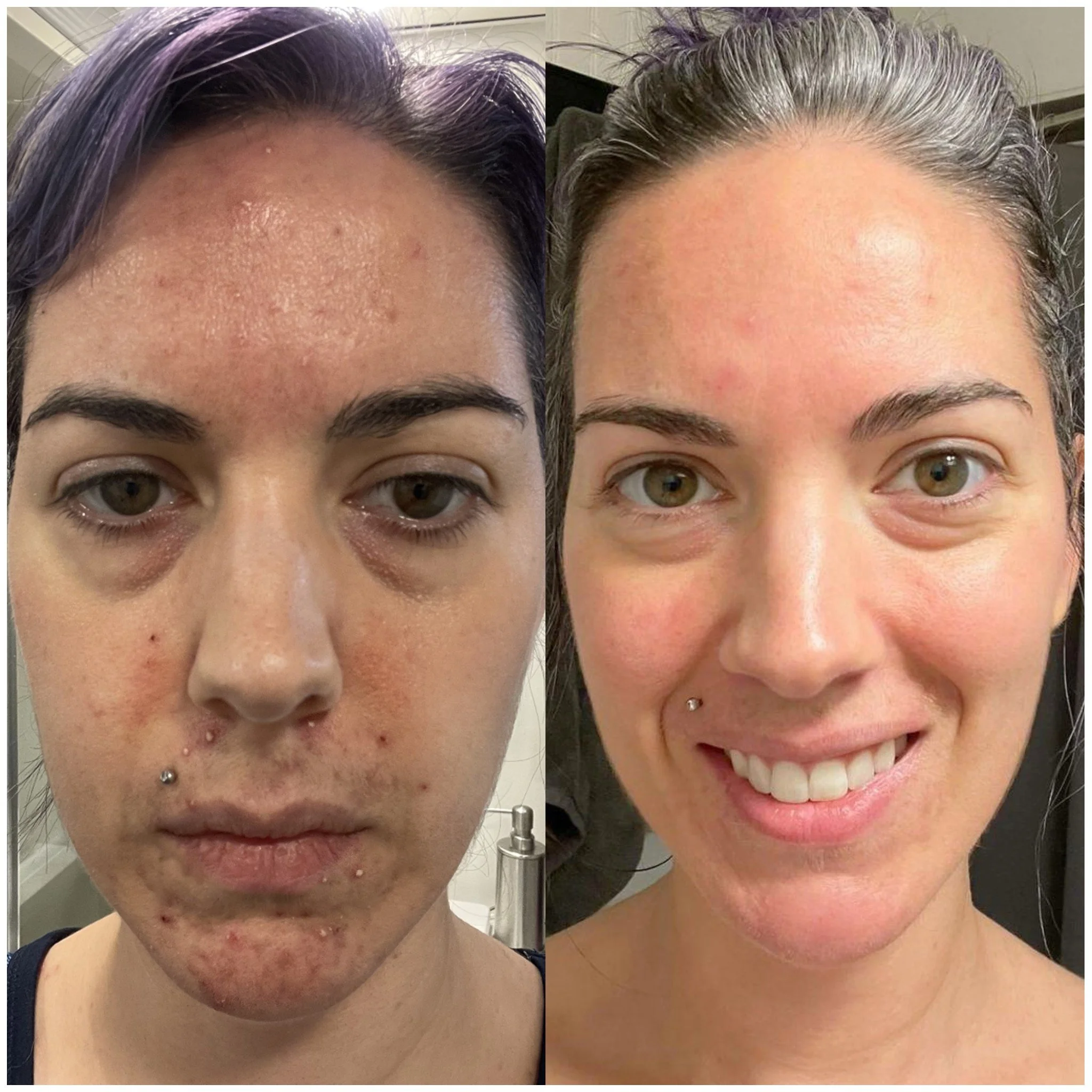 Virtual skin client progress