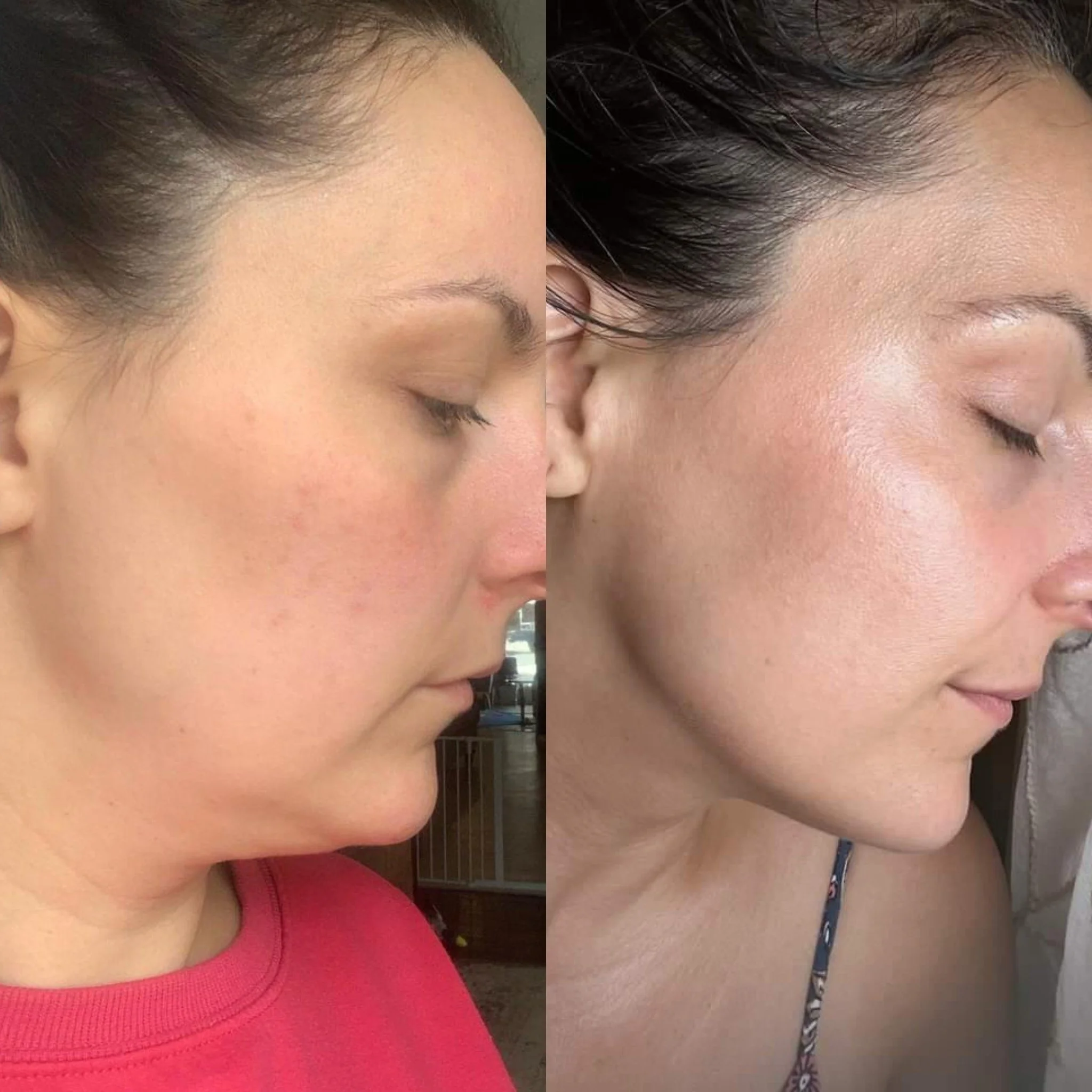 Side-by-side comparison of a woman's face before and after skincare, showing glowing, sculpted skin after regular facial massage. Katey Kristabelle Results Mindful Beauty