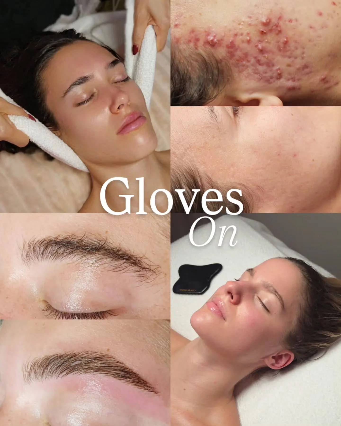 Gloves on, gloves off &mdash; your skin fairy 24/7 🧚&zwj;♀️✨️