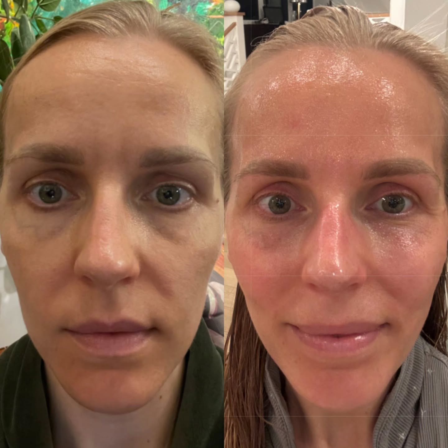 My clients age in reverse🪄.

This is the power of consistently caring for your skin inside &amp; out.

These results are 2 years apart &mdash; a reflection of intention, nourishment, and skin support that goes deeper than surface level for long last