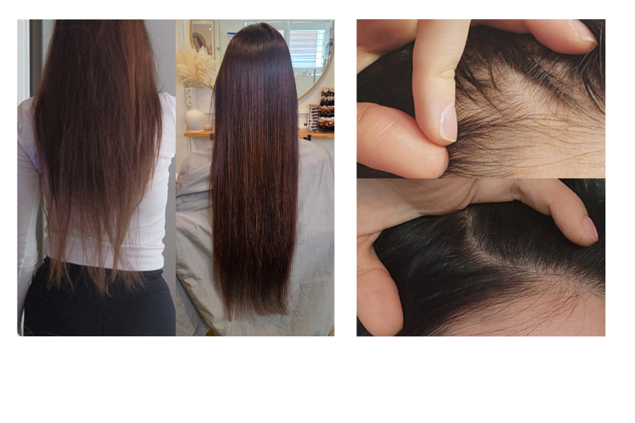 Hair Loss &amp; Hair Thinning: My Root-to-End Routine for Long, Healthy Hair
