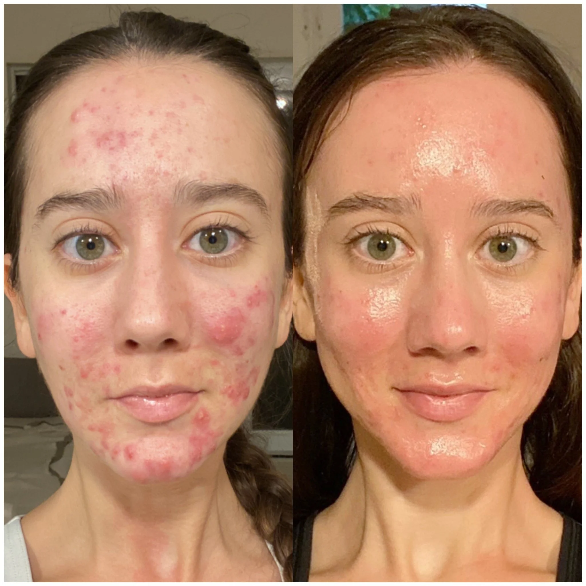 Holistic Consult Progress