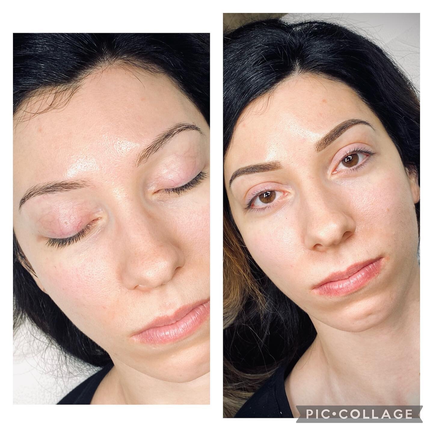 Powder Brow for a my nurse client that has a busy life and a crazy work schedule. Powder brow technique is similar to a tattoo. The light and airy finish is achieved by using the right cartridges, in this case I used @kwadron 30/1RLLT @microbeauoffic