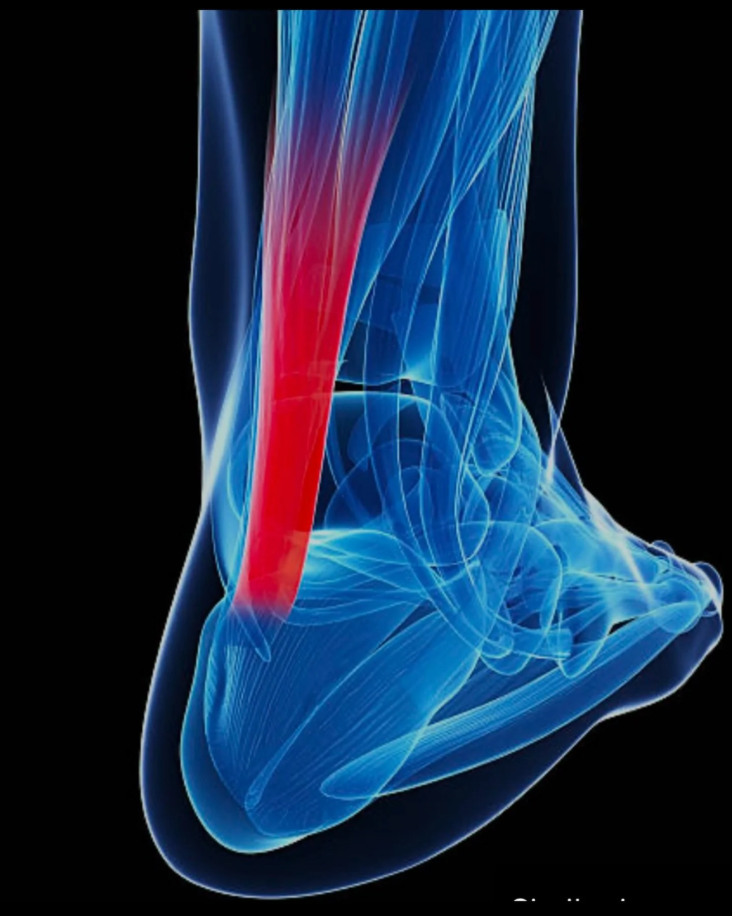 Tendon Health: The Power of Proper Loading

Tendon pain can be frustrating and often leads many of us to think that complete rest is the key to healing. But did you know that rest alone isn&rsquo;t the answer? While it might seem counterintuitive, re