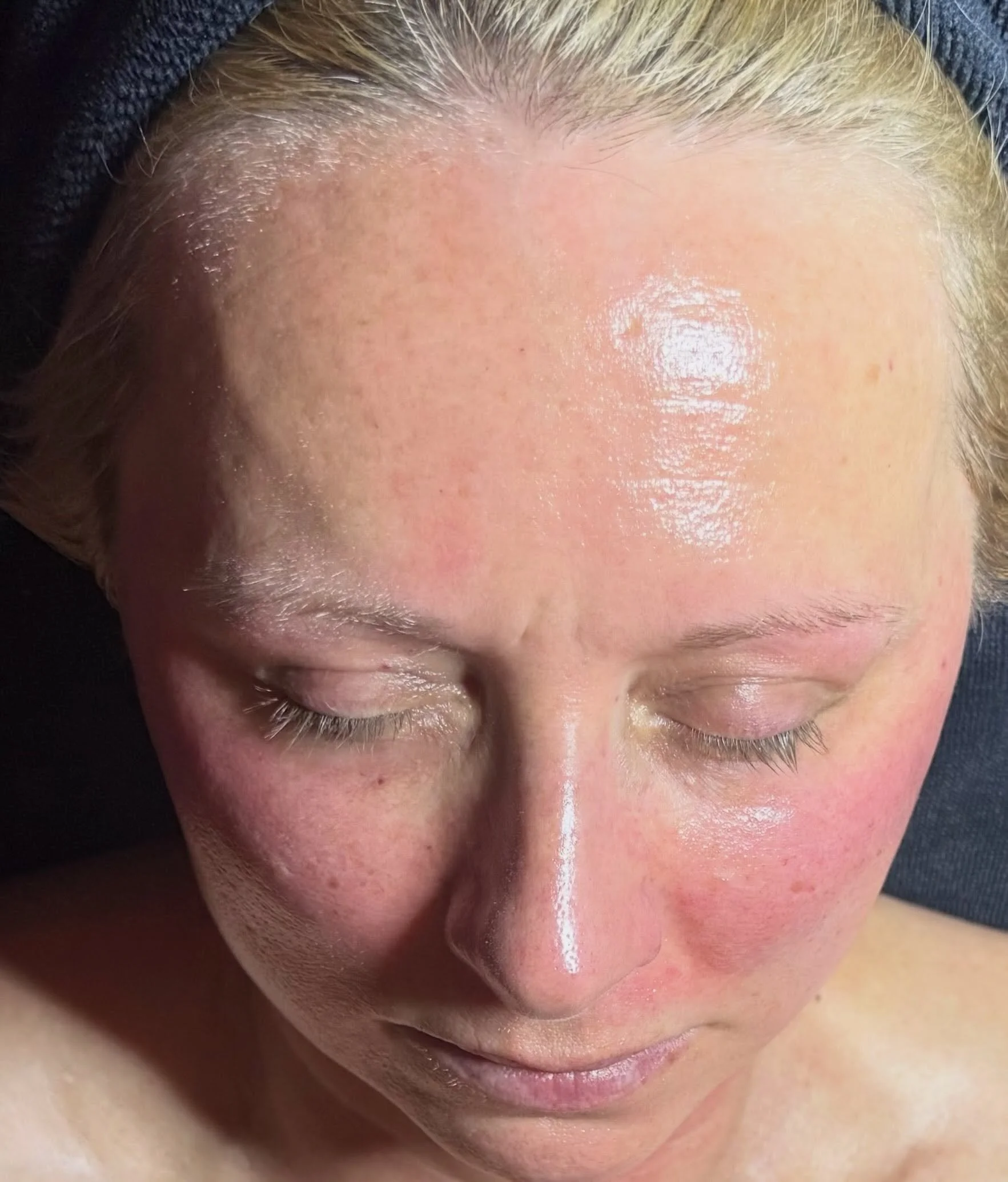 ✨ AFTER ➡️ BEFORE ✨

90 minutes. ALL Korean treatments. One seriously pampered complexion. 🇰🇷🤍

This treatment combined our Carboxy + VTOX treatments for the ultimate Korean skincare experience&mdash;designed to leave the skin looking refreshed, s