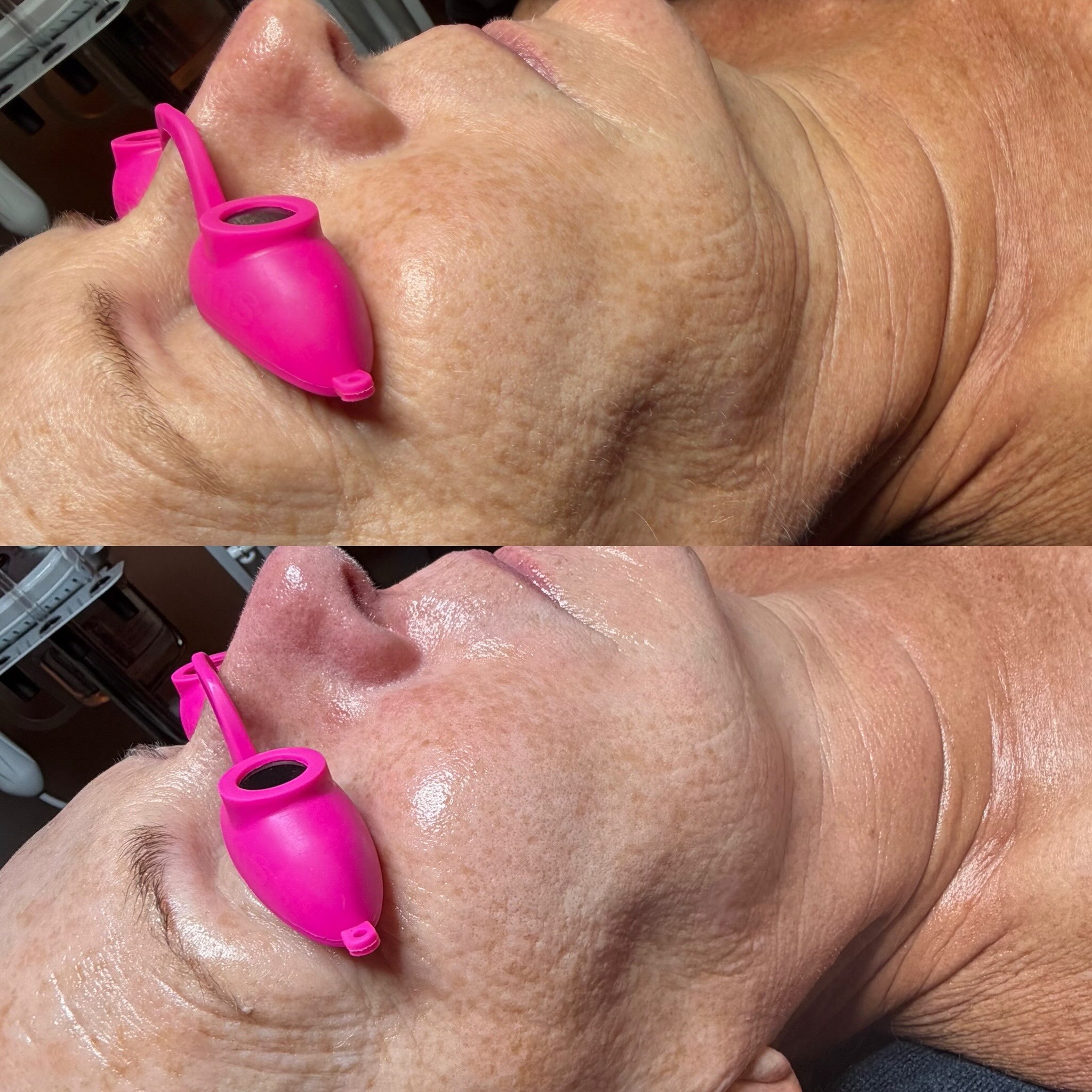 ✨ THIS IS WHAT YOUR SKIN HAS BEEN MISSING! 🇰🇷🤎

That glow isn&rsquo;t a filter&hellip; it&rsquo;s the power of Korean skincare!

Deep hydration, nourishment, and real results that go beyond your typical facial. ✨

At True Skin Spa, we&rsquo;re all