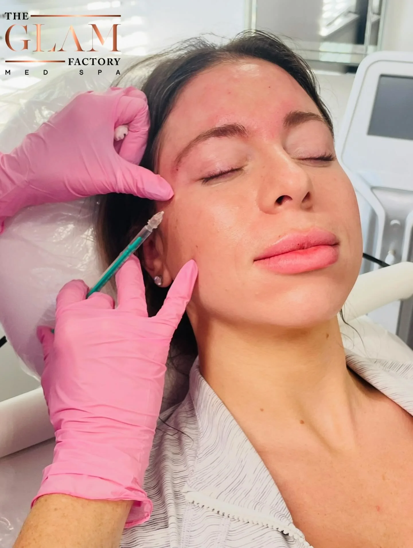 Botox isn&rsquo;t a one-time fix, it&rsquo;s a routine to be followed.

Staying consistent every 3&ndash;4 months keeps lines soft, results natural, and wrinkle prevention on point. 💉✨

#bostonbotox #botoxboston #bostonmedspa #braintreema #botoxxbar