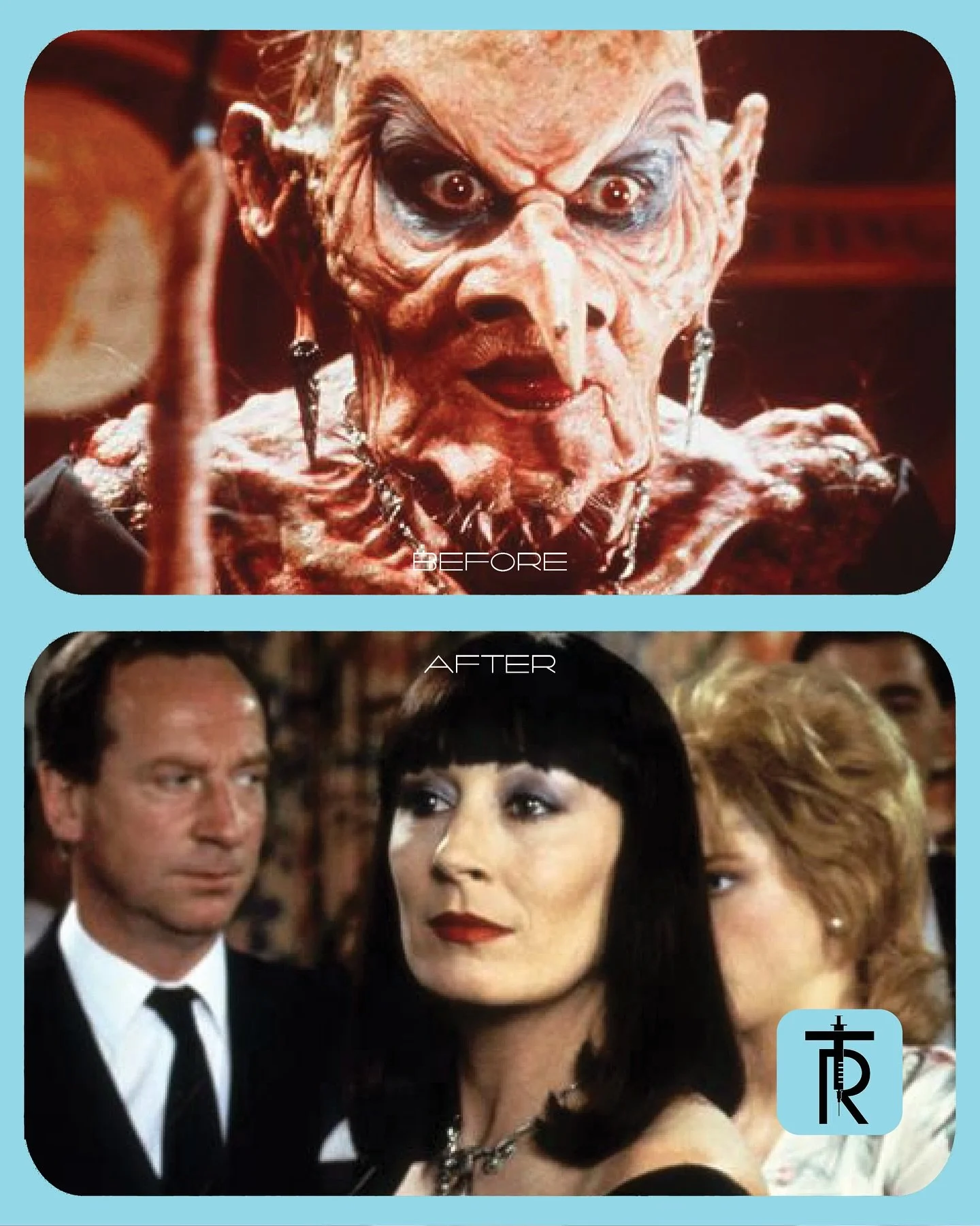 Trick or Treat? Your choice. Happy #Halloween 🎃 

📞 Call 212-970-8433 to book an appointment 💉